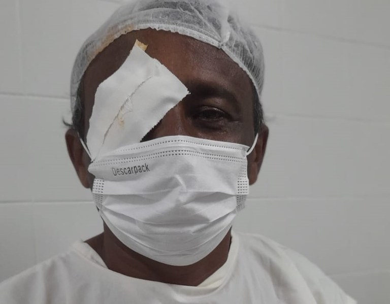 Opera Paraíba realiza mutirão de cirurgia de pterígio no Hospital de Clínicas de Campina Grande