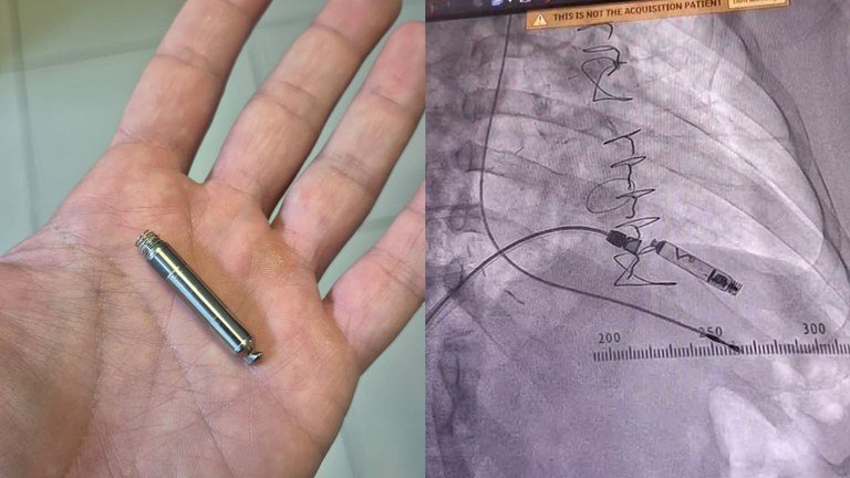 rascunho automatico 8